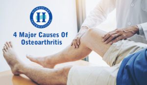 Read more about the article 4 Major causes of osteoarthritis
