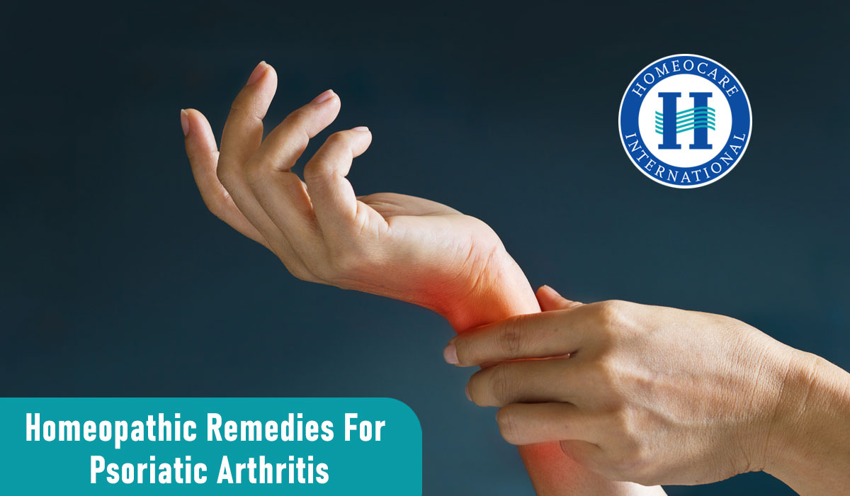 Read more about the article Homeopathic remedies for psoriatic arthritis