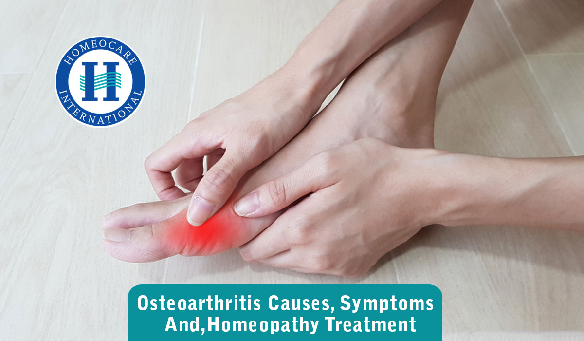 You are currently viewing Osteoarthritis Causes, Symptoms and, Homeopathy Treatment.