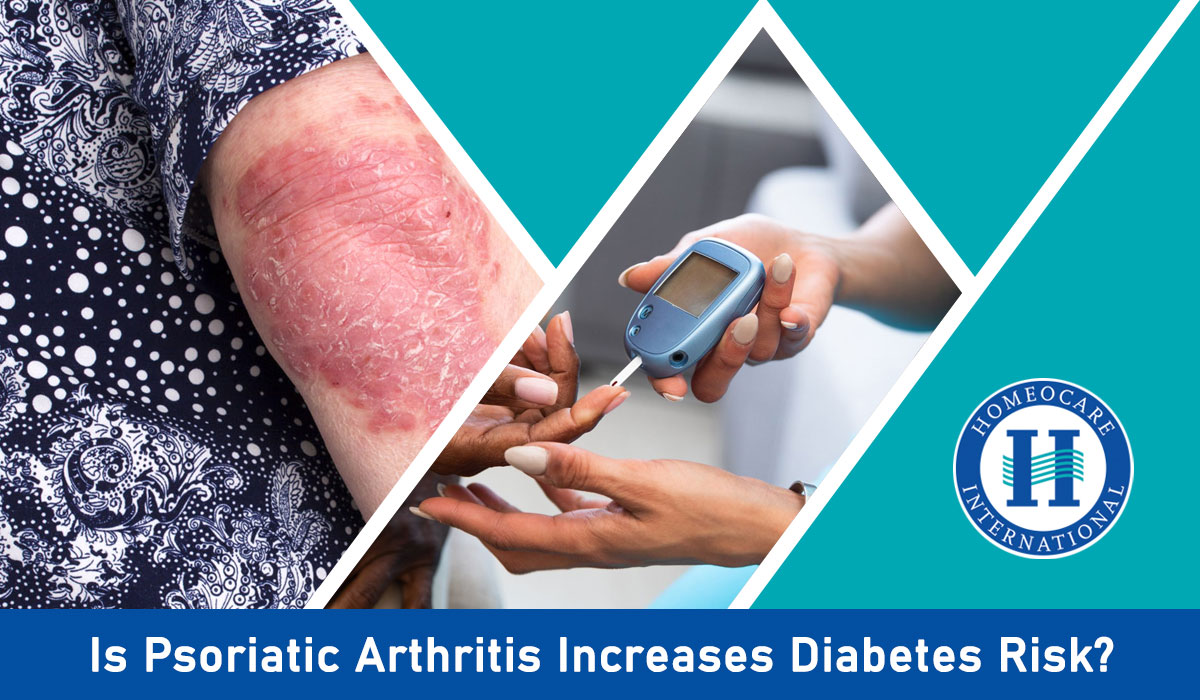 Read more about the article Does Psoriatic Arthritis Increase Diabetes Risk?