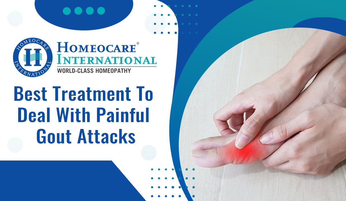You are currently viewing Best Treatment to Deal with Painful Gout Attacks