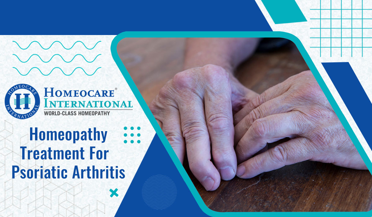 Read more about the article Homeopathy treatment for psoriatic arthritis