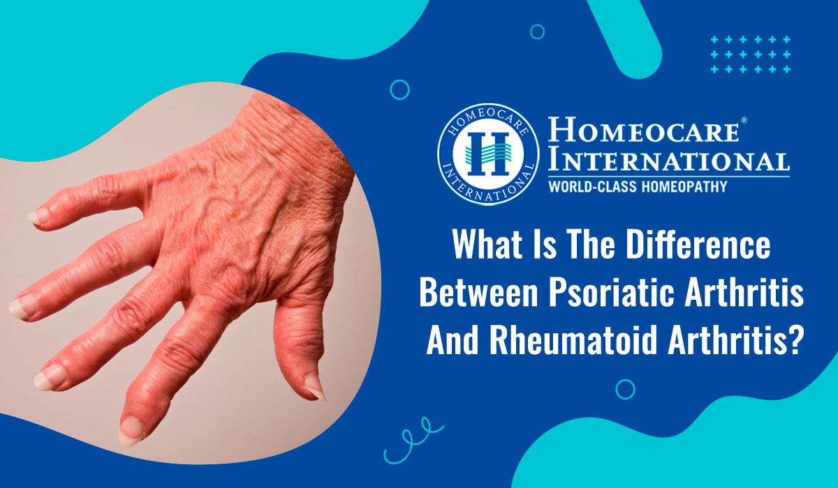 Read more about the article What is the difference between PsA and RA?
