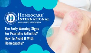 Read more about the article The early warning signs for psoriatic arthritis?